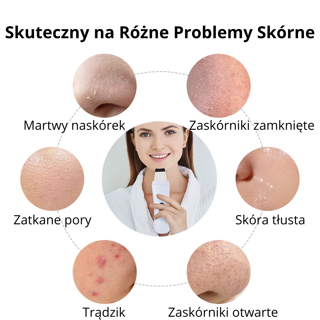 GlowPeel Pro – Peeling Ultradźwiękowy 4w1