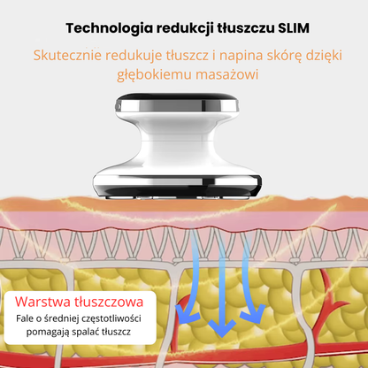 NovaSlim RF+EMS – inteligentny masażer wyszczuplający